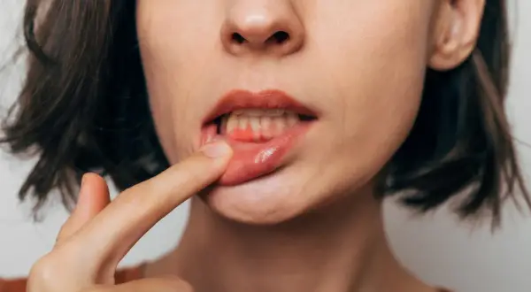 Jak usunąć jedzenie z dziąsła? Domowe sposoby i kiedy iść do dentysty