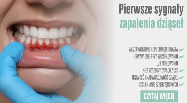 Zaczerwienione, opuchnięte dziąsła i krwawienie to pierwsze sygnały zapalenia dziąseł. Dowiedz się więcej.