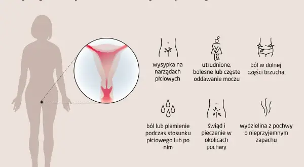 Objawy infekcji narządów płciowych: wysypka, ból brzucha, problemy z oddawaniem moczu, ból podczas stosunku, świąd, pieczenie i nieprzyjemna wydzielina. To mogą być symptomy choroby wenerycznej.