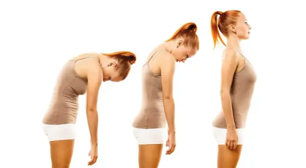 Tre pose a confronto: una donna con postura scorretta in piedi, poi leggermente meglio, e infine con postura corretta in piedi.