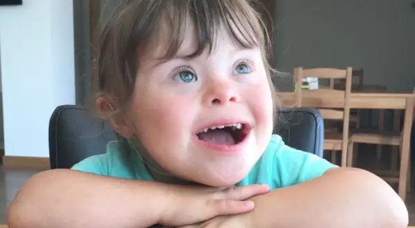 Una bambina down con occhi azzurri e un sorriso radioso, appoggiata al tavolo con le braccia incrociate.