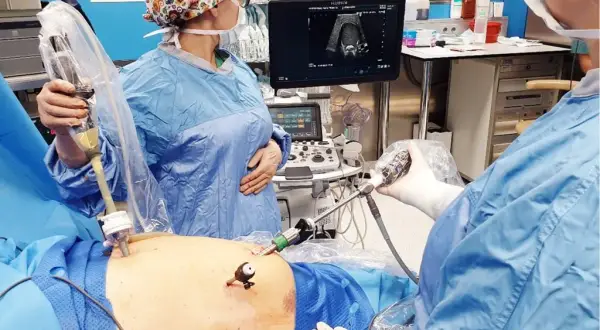 Co robi chirurg? Od diagnozy po salę operacyjną pełny przewodnik.