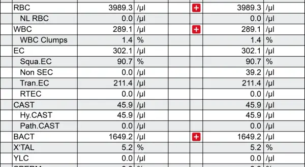 Czy badanie moczu wykryje raka? Sprawdź, co może ujawnić analiza moczu