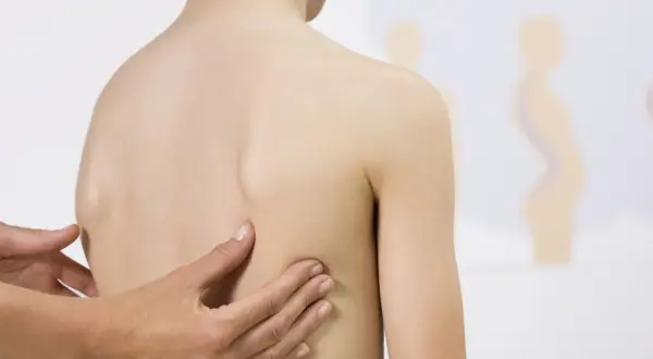 Mani di un medico esaminano la schiena di un bambino, evidenziando una possibile scoliosi cervicale.