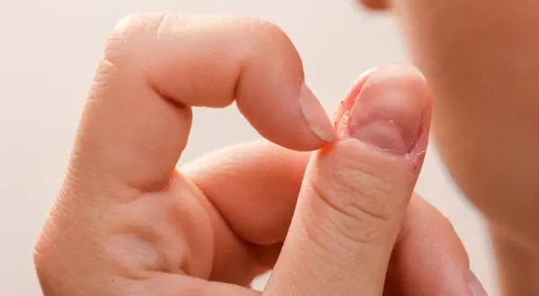 Zbliżenie na palec z widocznymi oznakami chorób paznokci, takich jak łuszczenie się skóry wokół paznokcia i jego nierówna powierzchnia.
