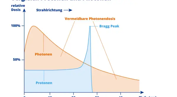 Vergleich von Protonen- und Photonen-Strahlendosis. Die Grafik zeigt, wie lange es dauert, bis Bestrahlung wirkt, und veranschaulicht die Tiefenwirkung.