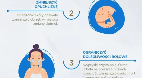 Zimny okład na pryszcze zmniejsza obrzęk i ból. Chłodzenie skóry przynosi ulgę.
