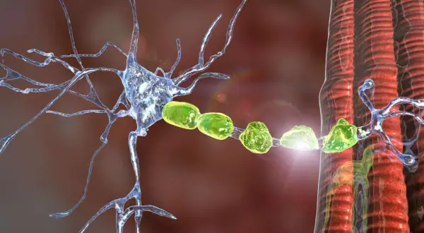 Danno alla mielina neuronale, simile a quello osservato nella Charcot-Marie-Tooth, con fibre nervose e muscolari.
