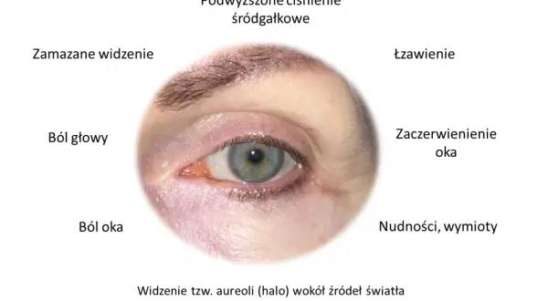 Ile trwa atak jaskry? Działaj szybko, by ratować wzrok!