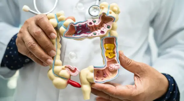Lekarz pokazuje model jelita grubego, ilustrując możliwości diagnostyczne co zamiast kolonoskopii.