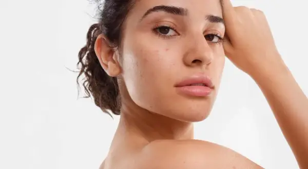 Une jeune femme au visage naturel, avec quelques imperfections, pose pour montrer comment avoir un beau visage.
