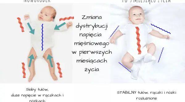 Wzmożone napięcie mięśniowe u niemowląt: Rozpoznaj objawy i działaj