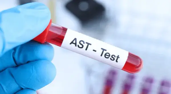 AST (Aminotransferaza): Rozszyfruj wyniki, normy i przygotowanie