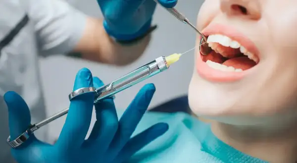 Dentysta podaje znieczulenie. Zastanawiasz się, ile kosztuje znieczulenie u dentysty? To zależy od zabiegu i rodzaju znieczulenia.