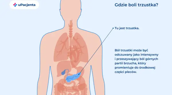 Ilustracja pokazuje lokalizację trzustki w ludzkim ciele. Ból trzustki może być intensywny i promieniować do pleców.