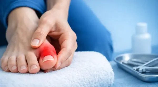 Eine Hand berührt einen roten, entzündeten Zeh, der starke Schmerzen in den Zehen signalisiert. Ein Handtuch und medizinische Instrumente liegen bereit.