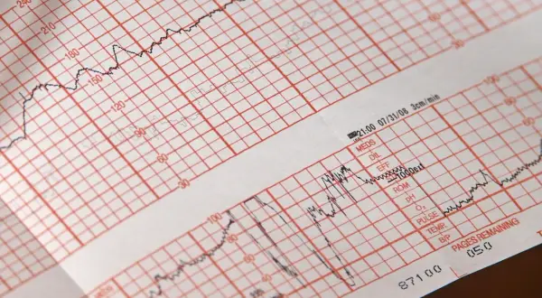 EKG: Przygotowanie krok po kroku. Pewny wynik bez obaw!