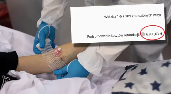 Podsumowanie kosztów refundacji: 6 830,63 zł. Czy to koszt zabiegu entropium?