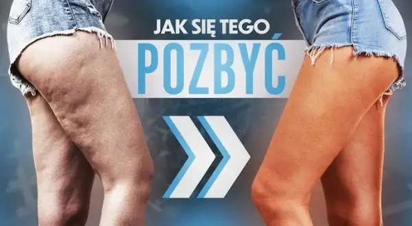 Jak skutecznie pozbyć się cellulitu? Kompletny poradnik ekspertki.
