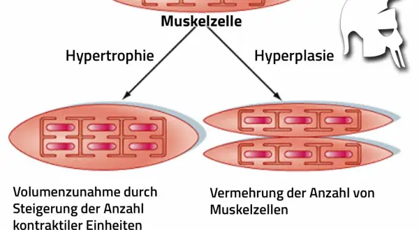 Sarkoplasmatische Hypertrophie: Muskelzelle wächst durch mehr kontraktile Einheiten. Daneben Hyperplasie: mehr Muskelzellen.