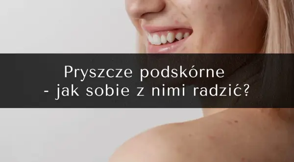 Bolesne pryszcze podskórne: Jak się ich pozbyć bez blizn?