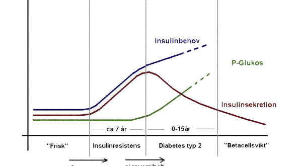 Graf som visar utvecklingen från "frisk" till insulinresistens, pre diabetes, och slutligen typ 2-diabetes. Insulinbehovet ökar, medan insulinsekretionen minskar.