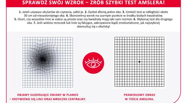 Test Amslera pokazuje zniekształcone linie, sugerując zmiany w plamce żółtej. Domowe sposoby na zwyrodnienie plamki żółtej mogą obejmować regularne badania wzroku.