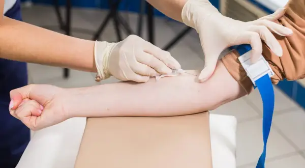 Jakie badania krwi do urologa są kluczowe dla Twojego zdrowia?