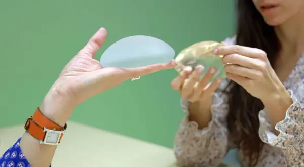 Une main présente un implant mammaire, tandis qu'une autre femme examine un implant différent. Discussion sur la réduction mammaire.