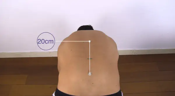 Messung der Flexibilität des Rückens mit dem Schober-Test. Markierungen zeigen 20 cm Abstand.