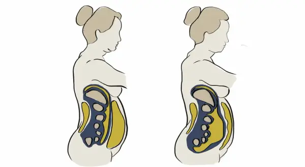 Vergleich zweier Bauchprofile: Links ein vollerer Bauch mit sichtbarem Bauchfett, rechts ein schlankerer Bauch. Mögliche hormonelle Einflüsse auf den Bauch werden angedeutet.