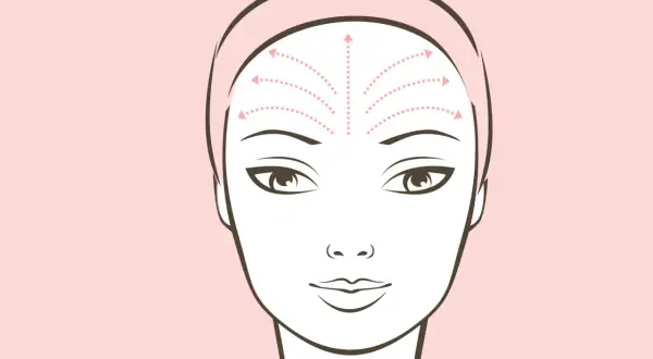 Illustrazione di un viso con frecce che indicano movimenti verso l'alto sulla fronte, suggerendo l'effetto lifting significato.