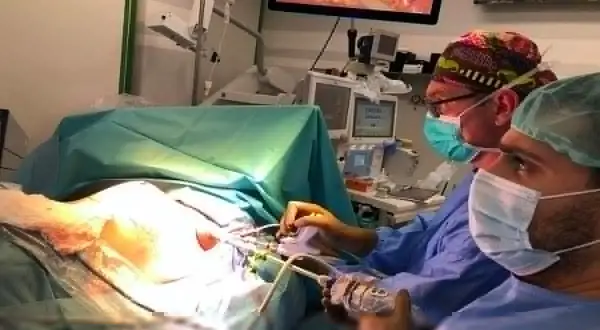 Chirurdzy podczas operacji, która może być przykładem tego, co to jest mastektomia. Na ekranie widać obraz z wnętrza ciała.