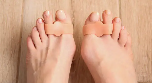 Separatori per dita dei piedi per correggere l'alluce valgo inizio.
