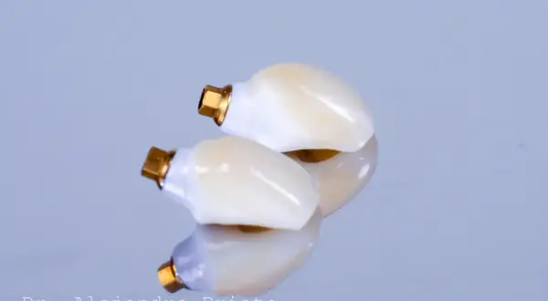 Dos coronas dentales con base dorada, reflejadas en una superficie pulida. La marca "Dr. Alejandro Prieto" sugiere que es el mejor especialista en implantes dentales.