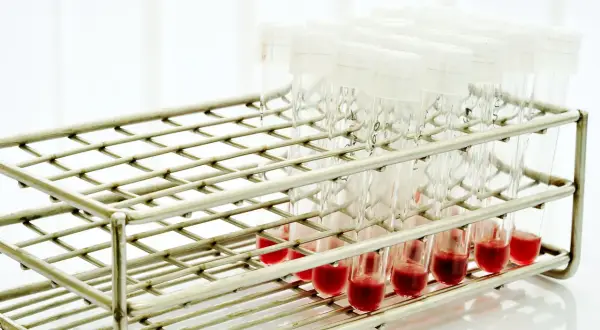 Rząd probówek z czerwoną surowicą w metalowym stojaku laboratoryjnym.