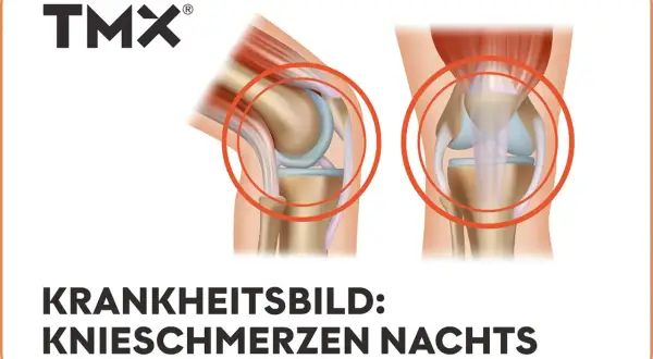 Anatomische Darstellung von Kniegelenken, die **Knieschmerzen nachts** thematisieren.