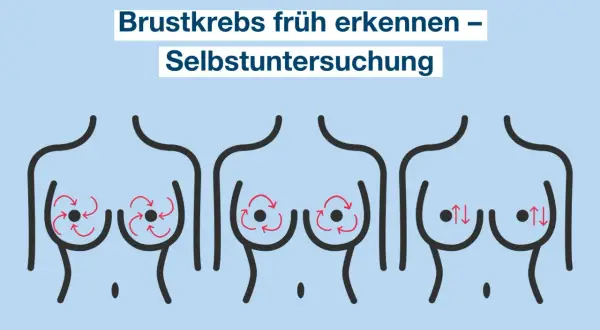 Brustkrebs früh erkennen durch Selbstuntersuchung. Illustration zeigt drei Brüste mit roten Pfeilen, die verschiedene Abtasttechniken darstellen.