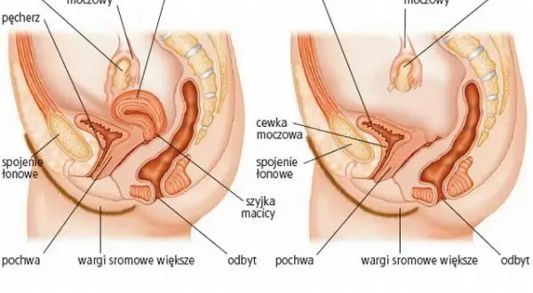 Histerektomia a miesiączka: Koniec okresu? Zrozum swoje ciało