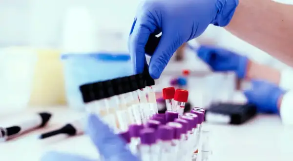 Ręce w niebieskich rękawiczkach przygotowują probówki do analizy. To ważny etap w procesie, jakim jest test na narkotyki.