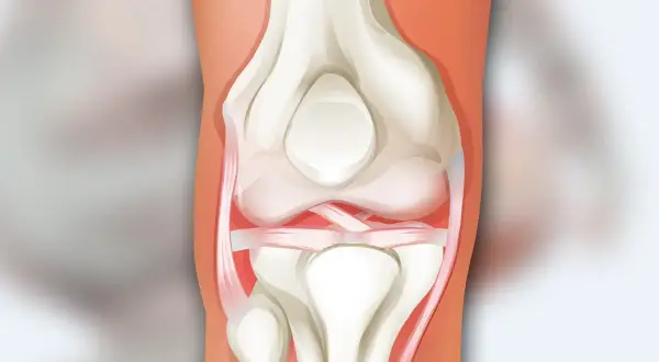 Anatomia stawu kolanowego: kości udowa i piszczelowa, rzepka oraz więzadła.
