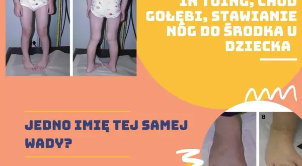 Dziecko z nogami skierowanymi do środka, co może być określane jako kaczy chód.