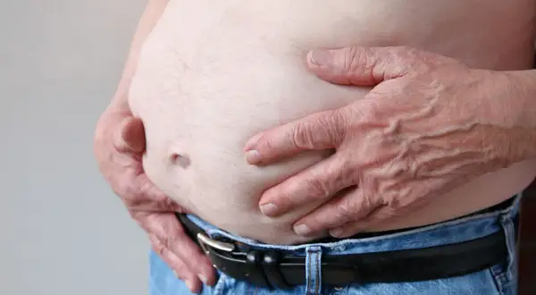 Osoba z zaawansowaną marskością wątroby, widoczny duży brzuch i dłonie obejmujące go.