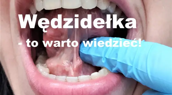 Kiedy zacząć ćwiczyć po podcięciu wędzidełka, aby uniknąć problemów?
