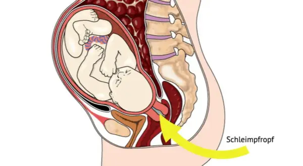 Der Schleimpfropf löst sich – ein Zeichen, dass die Geburt bald los geht. Das Baby liegt bereit im Mutterleib.