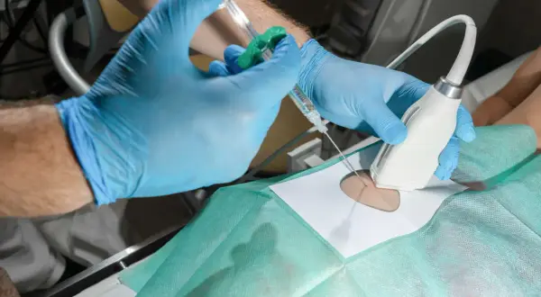 Lekarz pod kontrolą USG wykonuje iniekcję do stawu krzyżowo biodrowego.