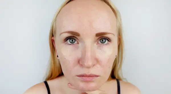 Blondynka z niejednolitą cerą, zastanawia się, co zrobić, żeby twarz się nie świeciła po nałożeniu podkładu.
