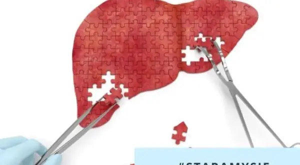 Wątroba z puzzli, którą składają szczypce. Badanie na obecność hbs antygen to klucz do zdrowia. #STARAMYSIĘ