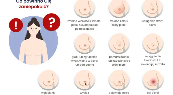 Objawy wskazujące na rozpadający się guz nowotworowy: zmiany w piersiach, guzki, wciągnięcie skóry, wyciek z brodawki, ból.