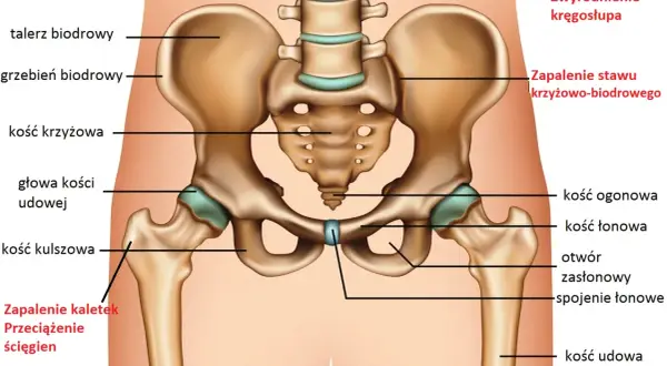 Anatomia miednicy i stawów biodrowych z zaznaczonymi strukturami kostnymi i schorzeniami.